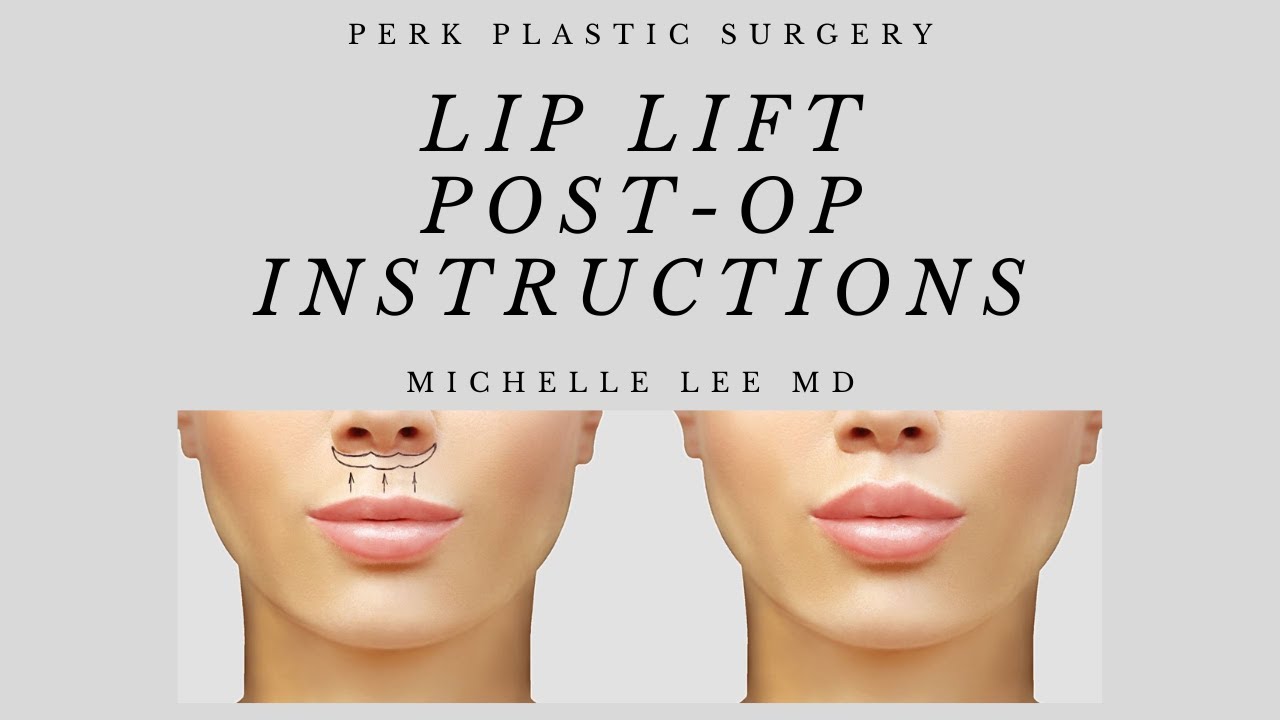 Facial Post-Surgery Instructions | PERK Plastic Surgery