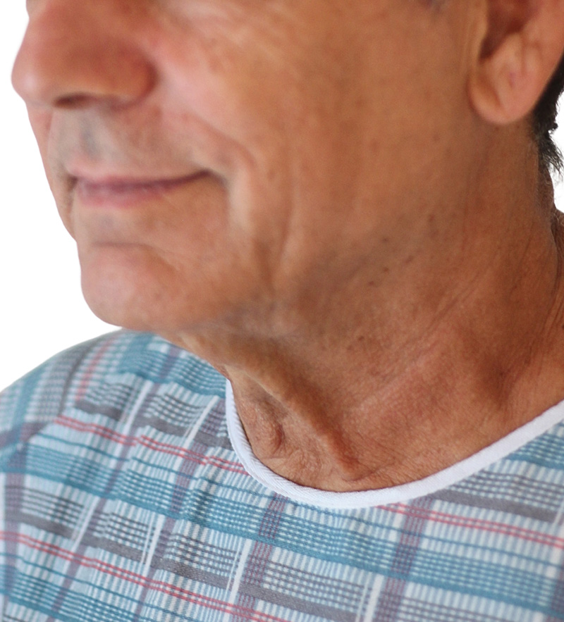 Facelift Before and After | PERK Plastic Surgery