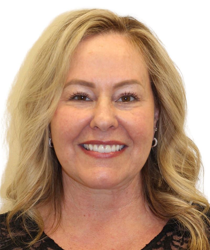 Facelift Before and After | PERK Plastic Surgery