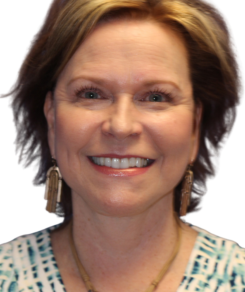 Facelift Before and After | PERK Plastic Surgery