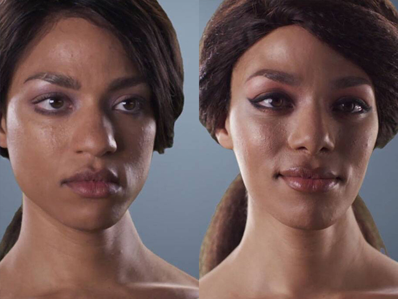 Facial Feminization Before and After | PERK Plastic Surgery