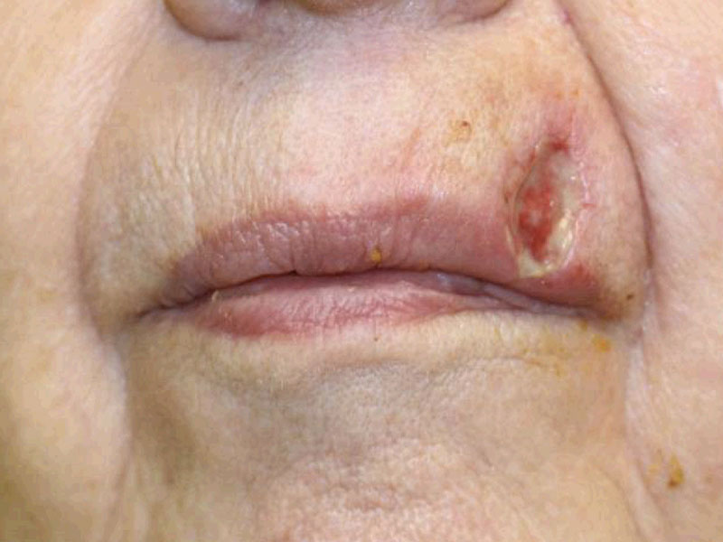 Facial Reconstruction Before and After | PERK Plastic Surgery