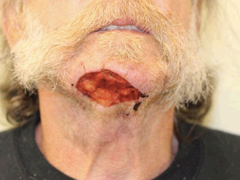 Facial Reconstruction Before and After | PERK Plastic Surgery