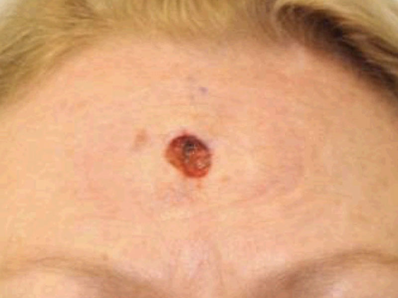 Facial Reconstruction Before and After | PERK Plastic Surgery