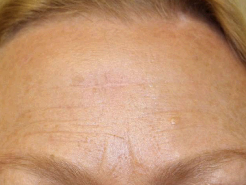 Facial Reconstruction Before and After | PERK Plastic Surgery