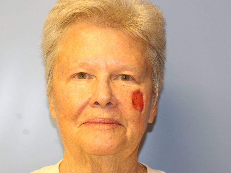 Facial Reconstruction Before and After | PERK Plastic Surgery