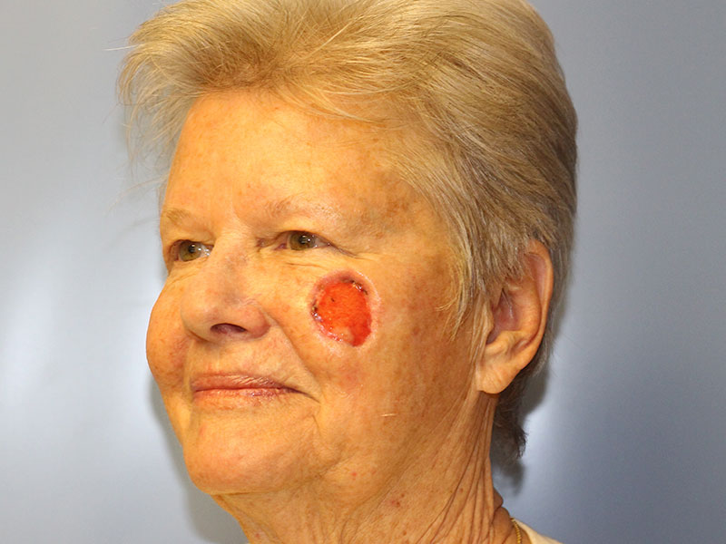 Facial Reconstruction Before and After | PERK Plastic Surgery