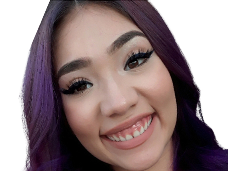 Botox Before and After | PERK Plastic Surgery