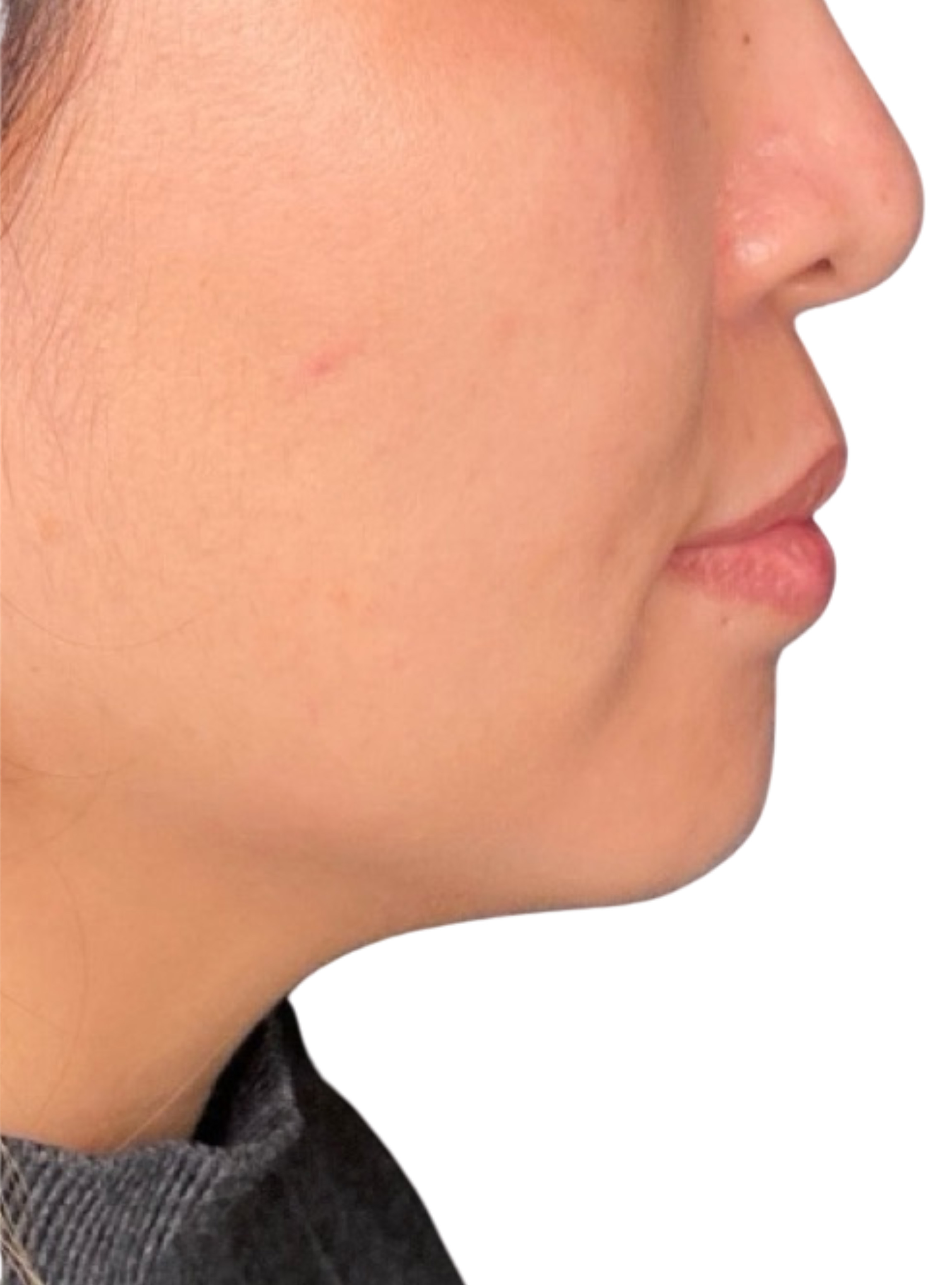 Skin Transformation Before and After | PERK Plastic Surgery