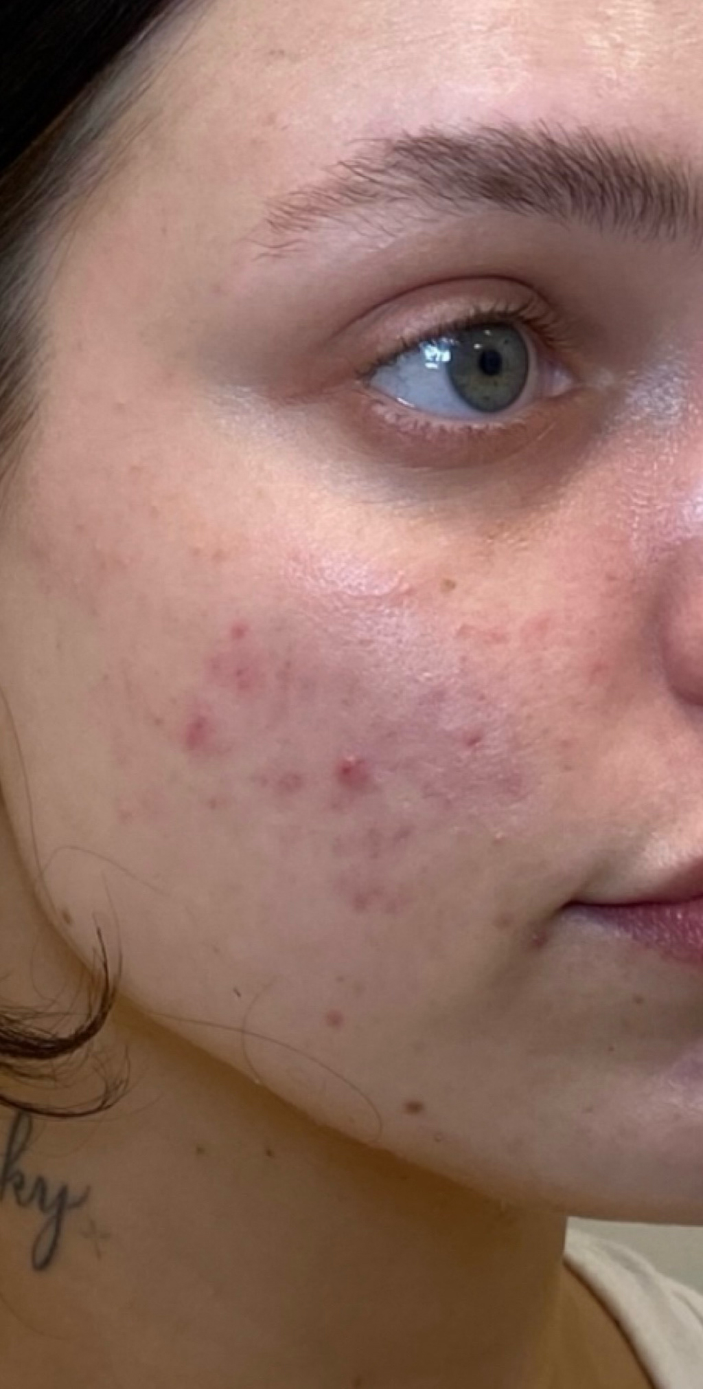 Skin Transformation Before and After | PERK Plastic Surgery