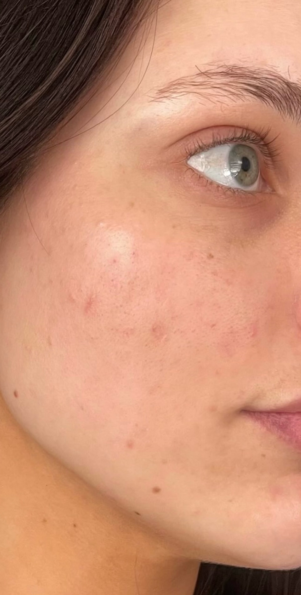 Skin Transformation Before and After | PERK Plastic Surgery