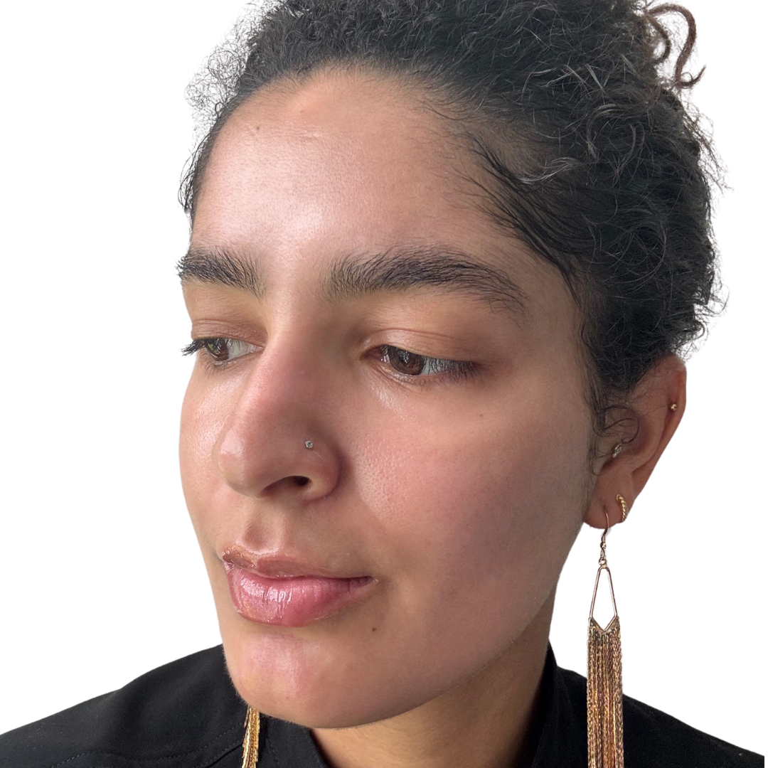 Skin Transformation Before and After | PERK Plastic Surgery