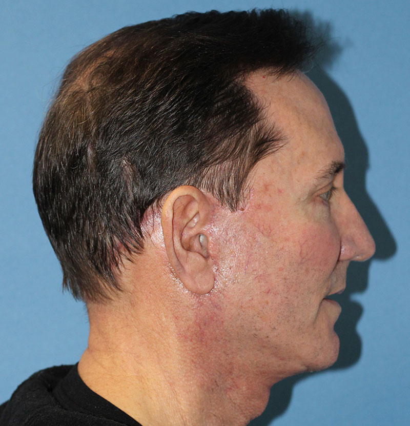 Plastic Surgery for Men | PERK Plastic Surgery