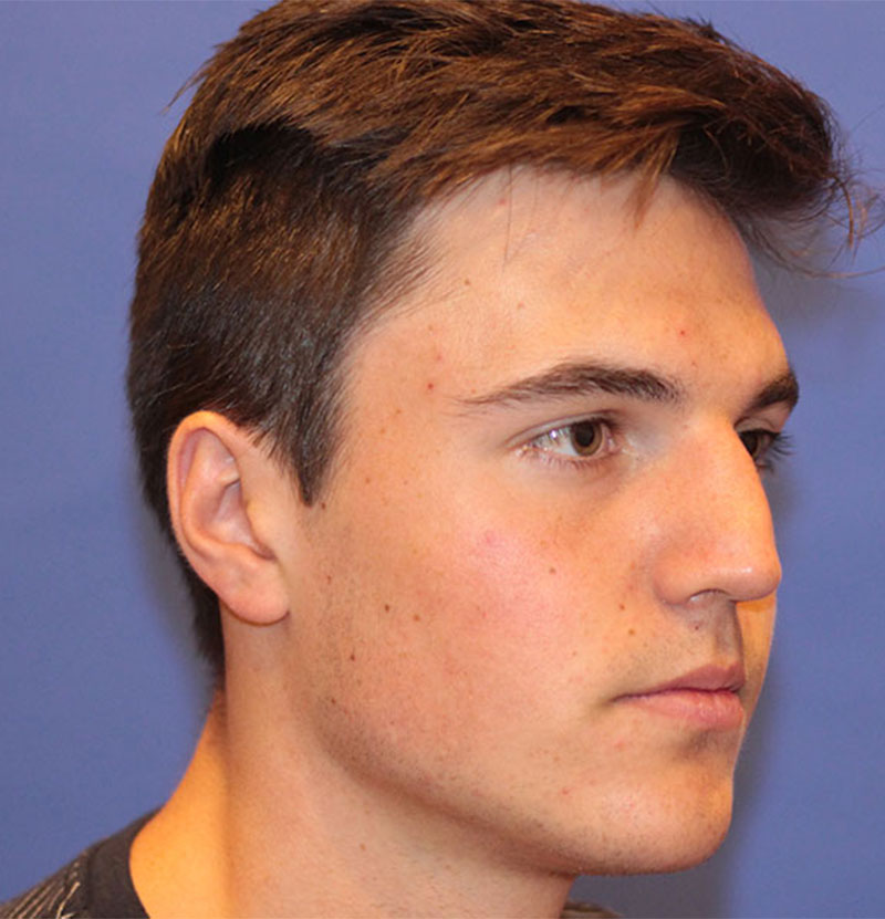 Plastic Surgery for Men | PERK Plastic Surgery