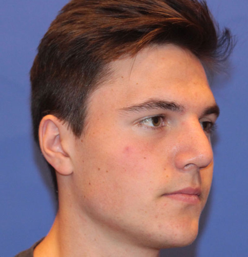 Plastic Surgery for Men | PERK Plastic Surgery